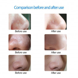 Mini Electric Facial Pore Cleanser Skin Cleaner Face Dirt Suck Up Vacuum Acne Pimple Tool Remover Blackhead Clean Massage Tool