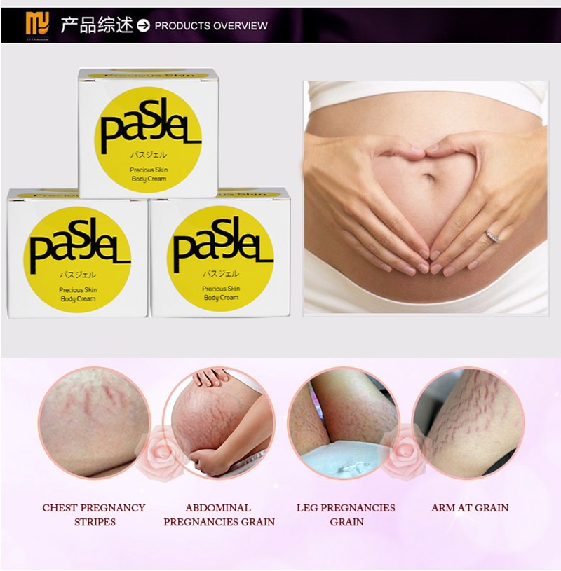 1piece-Pasjel-Cream-For-Stretch-Marks-And-Scar-Removal-Powerful-To-Stretch-Marks--Maternity-Skin-Bod-32874705621
